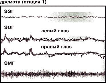 Фрагмент полиграммы